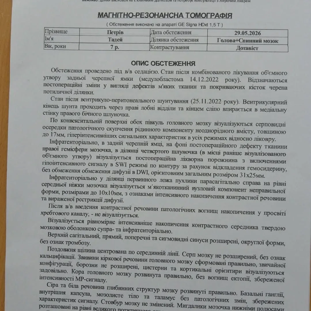 7-річний Тадей з Прикарпаття вдруге бореться з раком головного мозку: потрібна допомога
